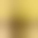 Blurred, unrevealed concept NFT artwork — BREAKOUT edition